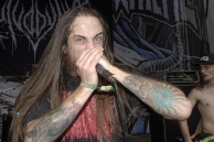 VULVODYNIA